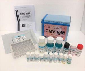 CMV IgM – ELISA