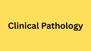 Urine Analysis